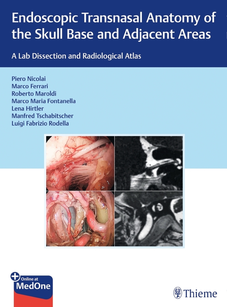 Endoscopic Transnasal Anatomy of the Skull Base and Adjacent Areas main product photo