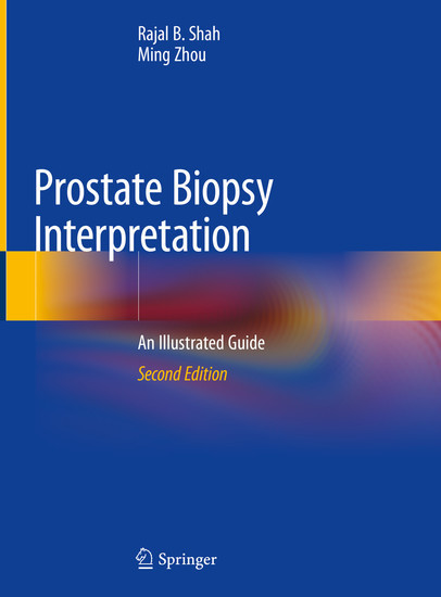Prostate Biopsy Interpretation main product photo