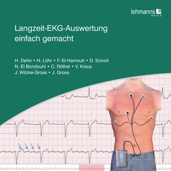 Langzeit-EKG-Auswertung einfach gemacht main product photo