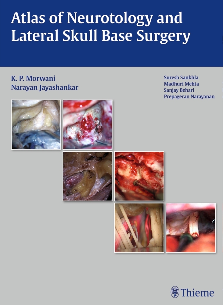 Atlas of Neurotology and Lateral Skull Base Surgery main product photo