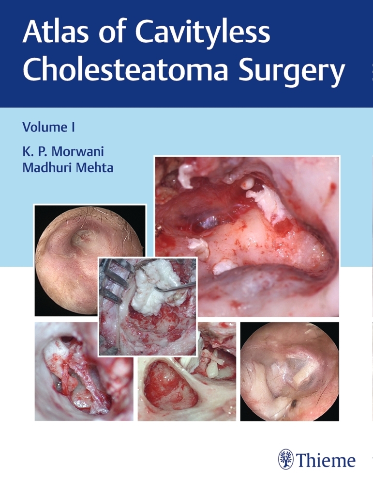 Atlas of Cavityless Cholesteatoma Surgery, Vol 1 main product photo