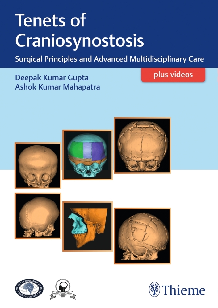 Tenets of Craniosynostosis main product photo