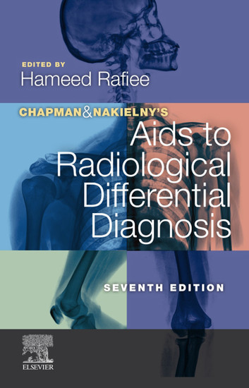 Chapman & Nakielny's Aids to Radiological Differential Diagnosis main product photo