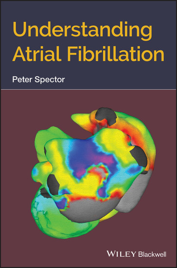 Understanding Atrial Fibrillation main product photo
