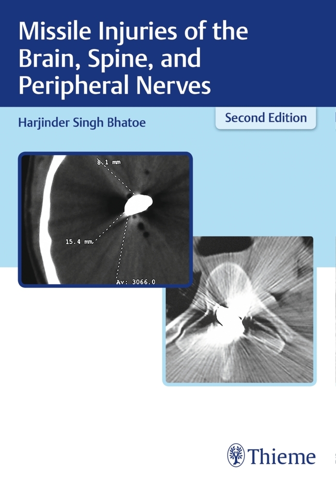 Missile Injuries of the Brain, Spine, and Peripheral Nerves main product photo