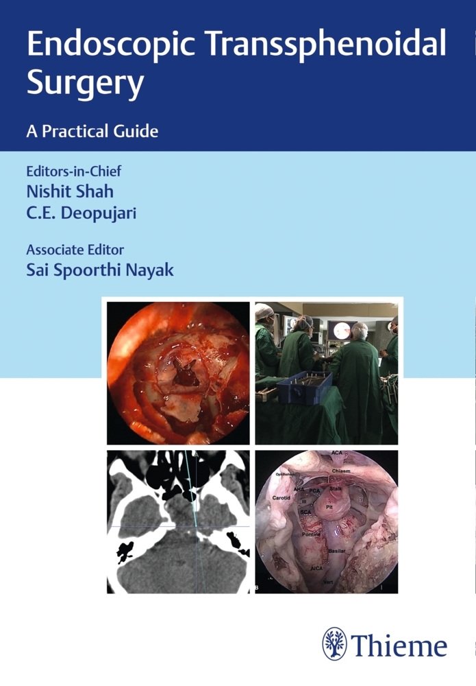 Endoscopic Transsphenoidal Surgery main product photo