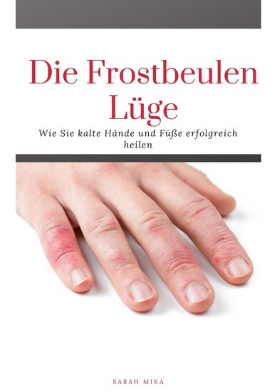 Die Frostbeulen Lüge main product photo