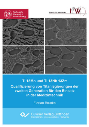 Ti 15Mo und Ti 13Nb 13Zr: Qualifizierung von Titanlegierungen der zweiten Generation f&#xFC;r den Einsatz in der Medizintechnik