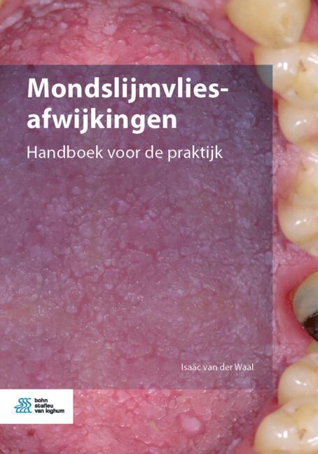Mondslijmvliesafwijkingen main product photo
