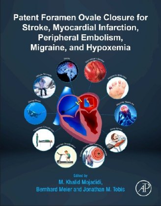 Patent Foramen Ovale Closure for Stroke, Myocardial Infarction, Peripheral Embolism, Migraine, and Hypoxemia