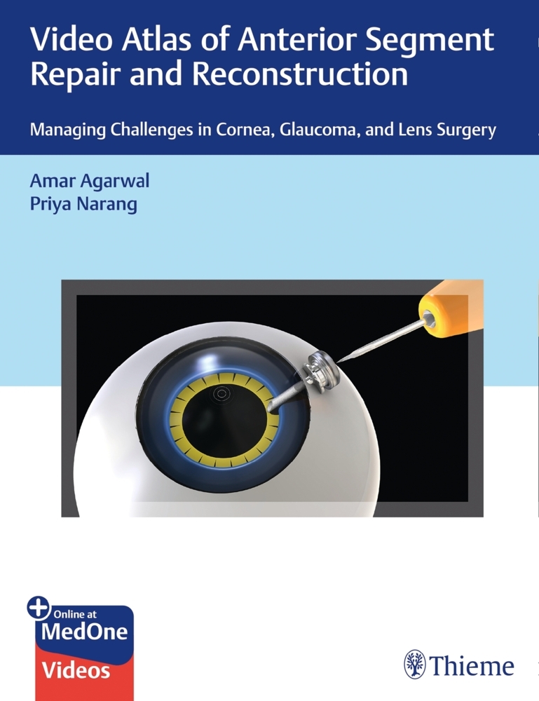 Video Atlas of Anterior Segment Repair and Reconstruction main product photo