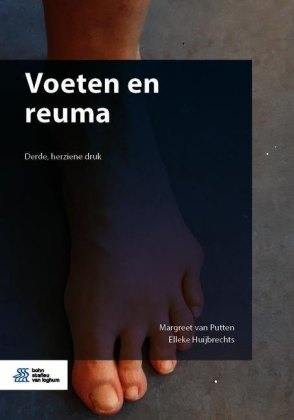 Voeten en reuma