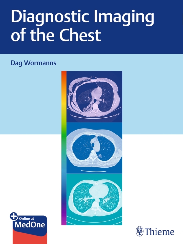 Diagnostic Imaging of the Chest main product photo