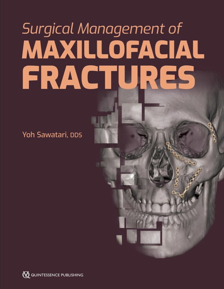 Surgical Management of Maxillofacial Fractures main product photo