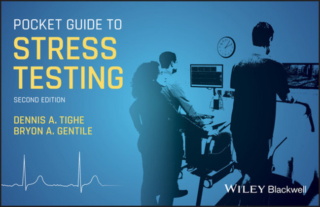 Pocket Guide to Stress Testing main product photo