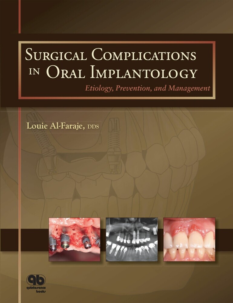 Surgical Complications in Oral Implantology main product photo