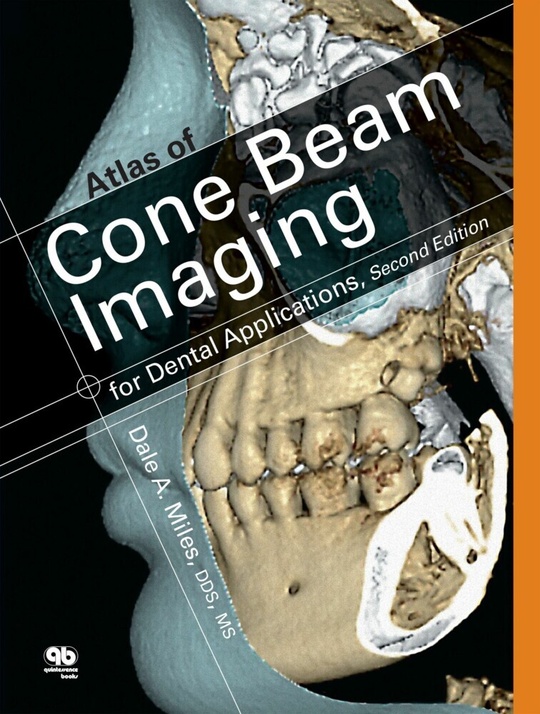 Atlas of Cone Beam Imaging for Dental Applications main product photo