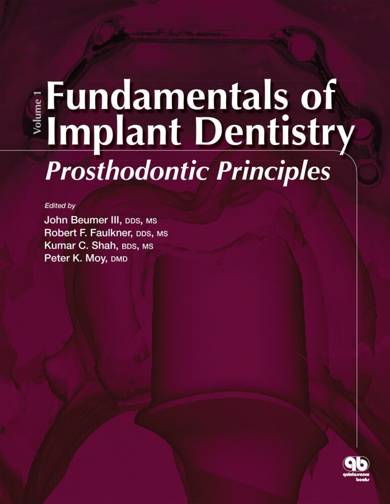 Fundamentals of Implant Dentistry, Volume 1 main product photo