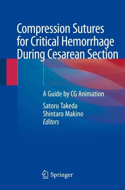 Compression Sutures for Critical Hemorrhage During Cesarean Section main product photo