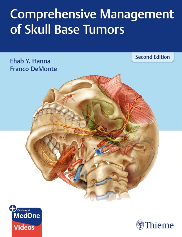 Comprehensive Management of Skull Base Tumors main product photo