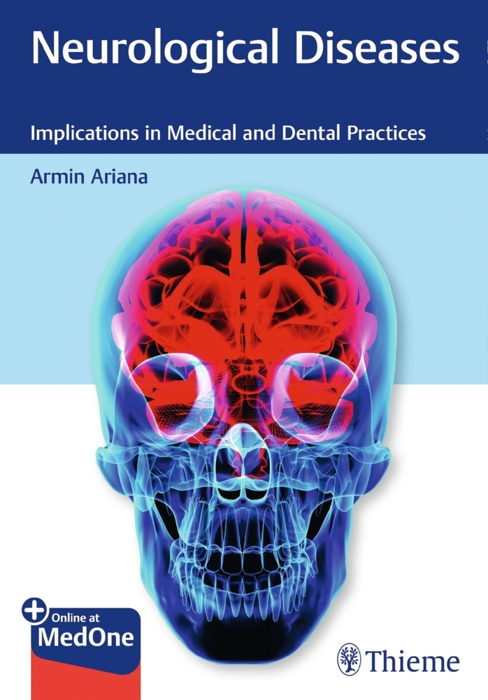 Neurological Diseases main product photo