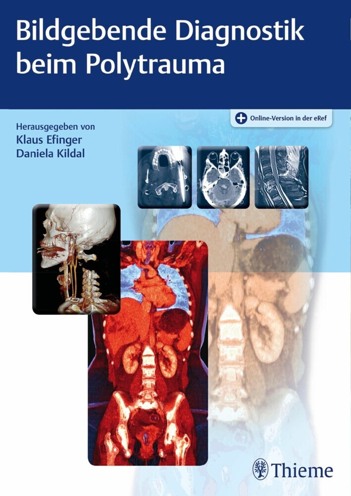 Bildgebende Diagnostik beim Polytrauma main product photo