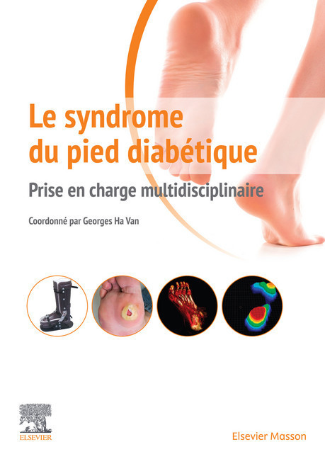 Le syndrome du pied diabétique main product photo