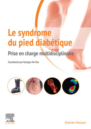Le syndrome du pied diabétique