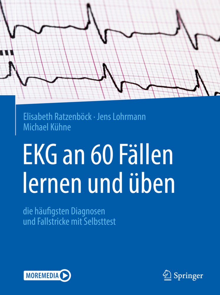 EKG an 60 Fällen lernen und üben, m. 1 Buch, m. 1 E-Book main product photo
