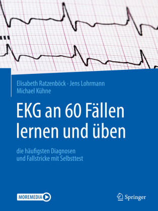 EKG an 60 Fällen lernen und üben, m. 1 Buch, m. 1 E-Book