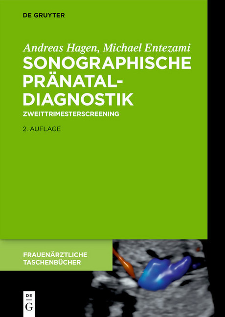 Sonographische Pränataldiagnostik main product photo