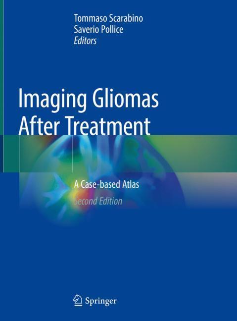 Imaging Gliomas After Treatment main product photo