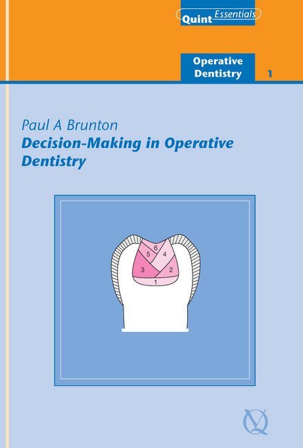 Decision-Making in Operative Dentistry main product photo