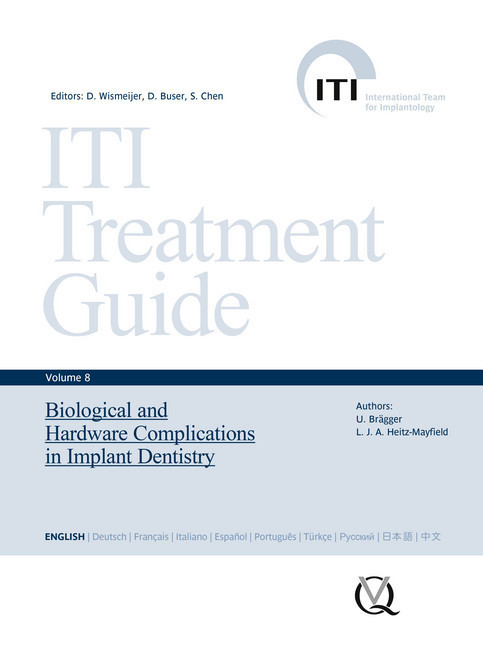 Biological and Hardware Complications in Implant Dentistry main product photo