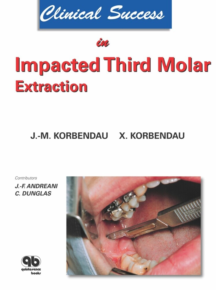 Clinical Success in Impacted Third Molar Extraction main product photo