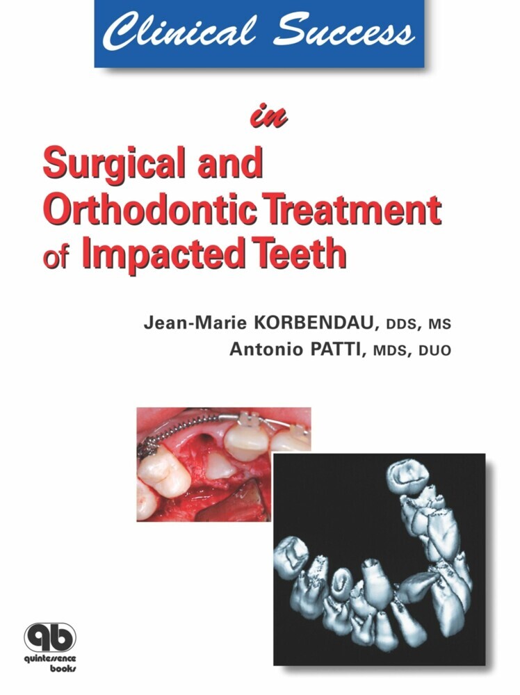 Clinical Success in Surgical and Orthodontic Treatment of Impacted Teeth main product photo