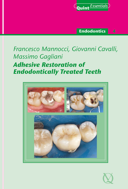 Adhesive Restoration of Endodontically Treated Teeth main product photo