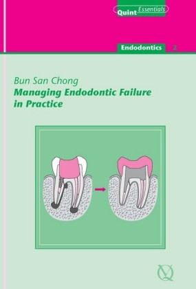 Managing Endodontic Failure in Practice