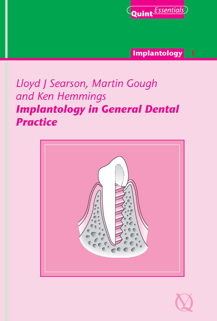 Implantology in General Dental Practice main product photo