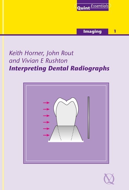 Interpreting Dental Radiographs main product photo