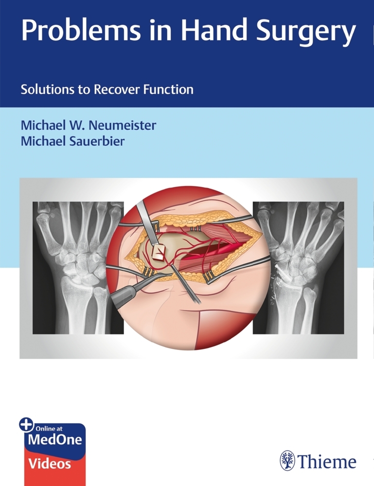 Problems in Hand Surgery main product photo