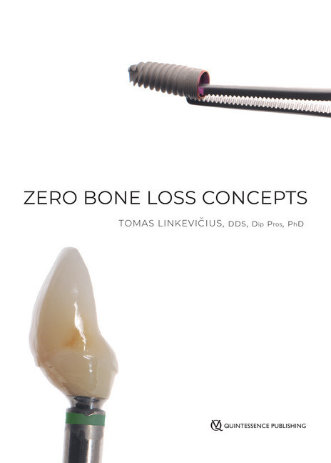 Zero Bone Loss Concepts main product photo