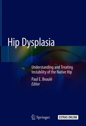 Hip Dysplasia