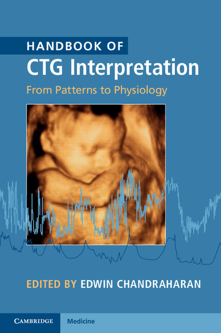 Handbook of CTG Interpretation main product photo