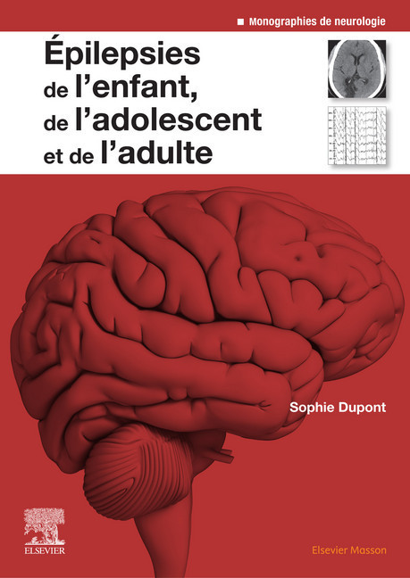 Epilepsies de l'enfant, de l'adolescent et de l'adulte main product photo