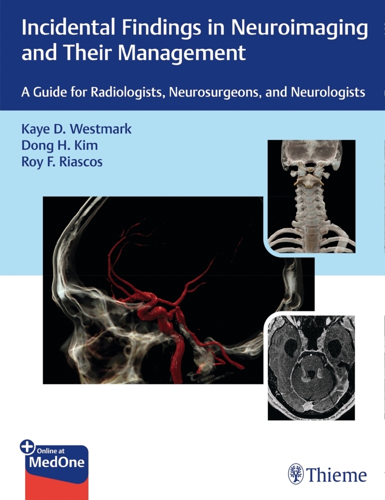 Incidental Findings in Neuroimaging and Their Management main product photo
