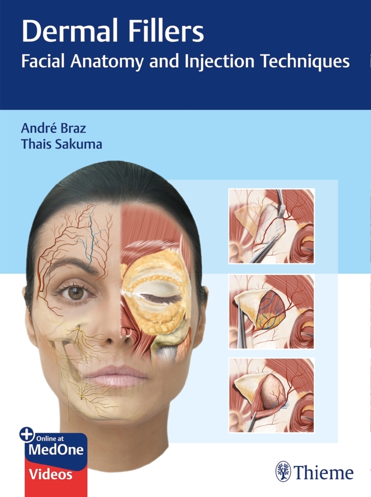 Dermal Fillers main product photo