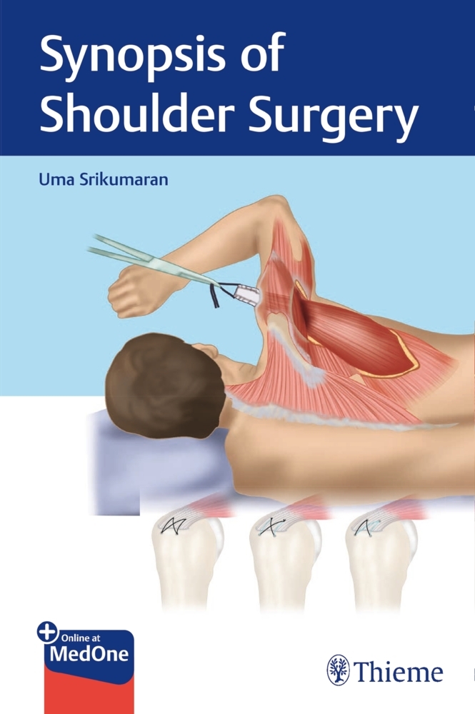 Synopsis of Shoulder Surgery main product photo