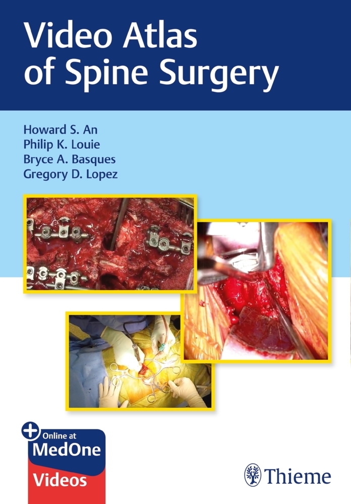Video Atlas of Spine Surgery main product photo
