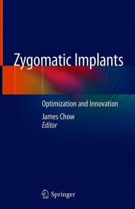 Zygomatic Implants